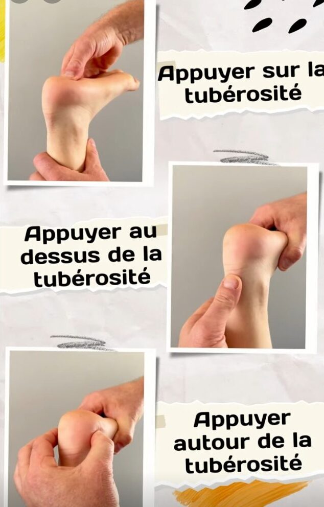Détecter Sever