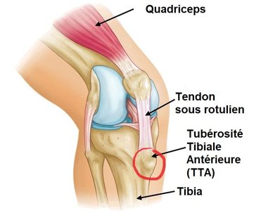 Traitement Osgood-Schlatter